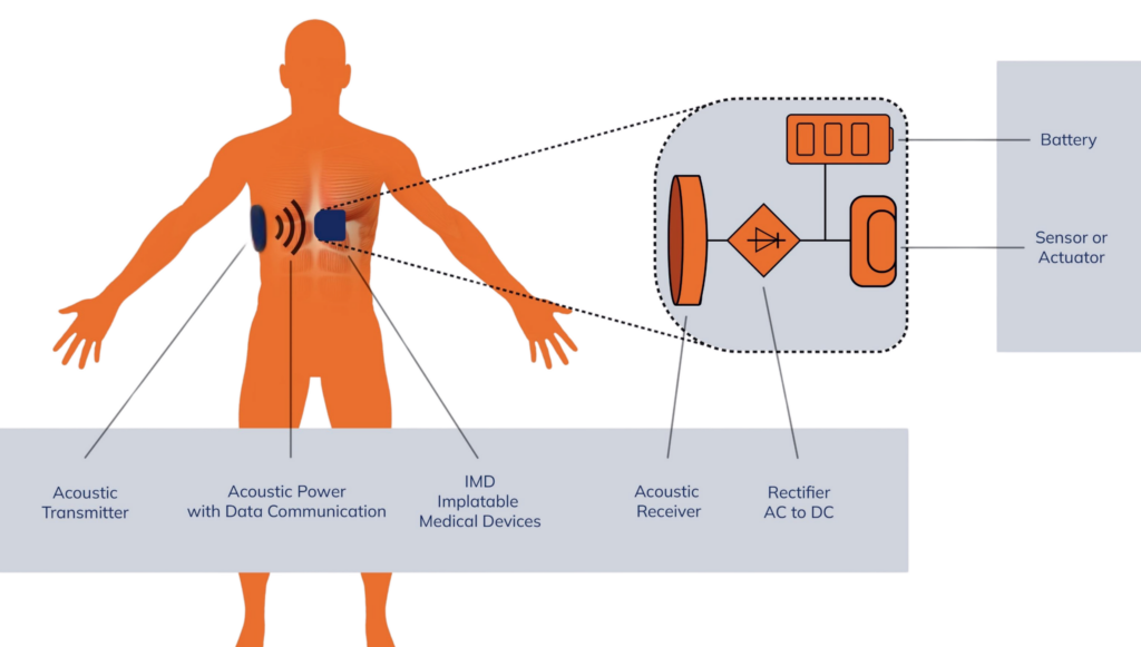 SmartUTET feeds next generation aimd