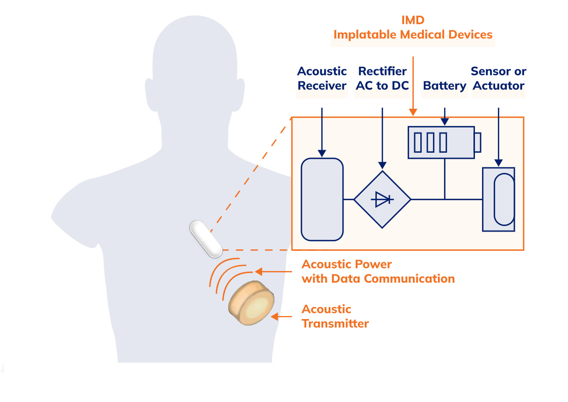 Bust info transmitter battery