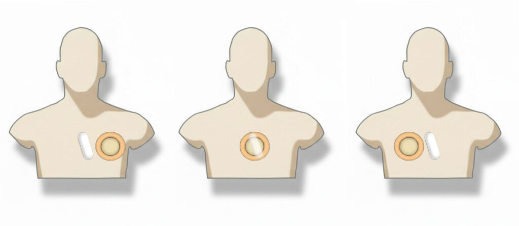 Three busts movement transmitter